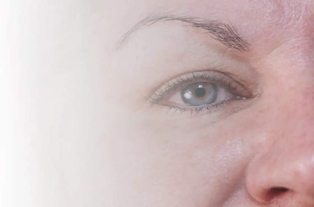 woman's eyebrows fading to white