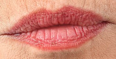 senior woman wtih lipstick lines